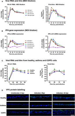 Airway Epithelial Cell Immunity Is Delayed During <mark class="highlighted">Rhinovirus</mark> Infection in Asthma and COPD